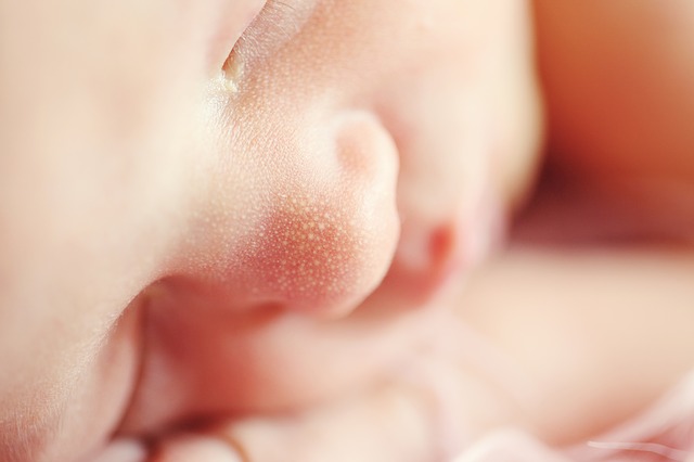 A Summary of Some Common Skin Rashes in Babies